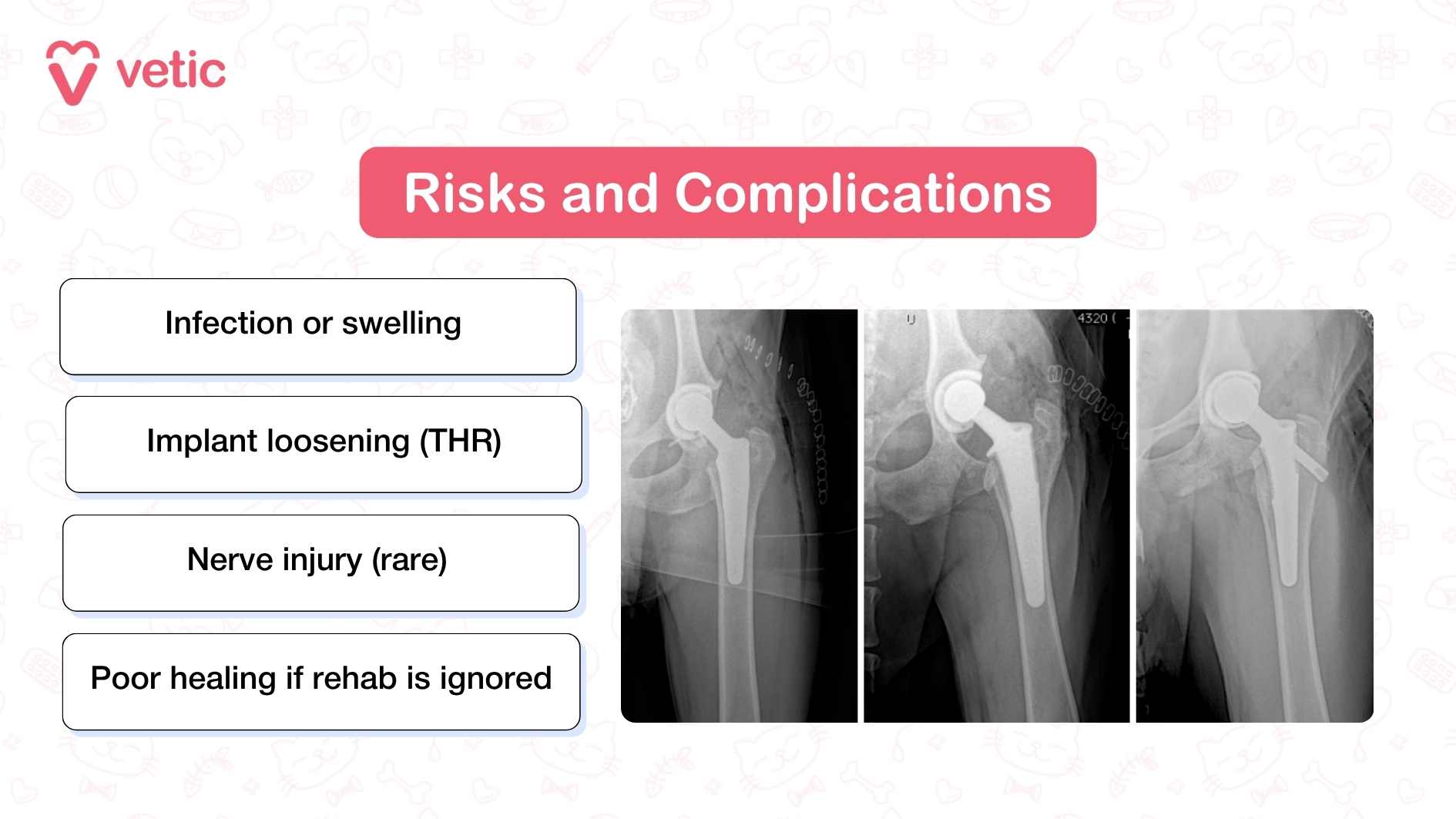 The image is titled “Risks and Complications of Hip Dysplasia Surgery” and highlights common concerns linked to hip dysplasia surgery in dogs. Four boxed points are listed: infection or swelling, implant loosening (specific to Total Hip Replacement), rare nerve injury, and poor healing if rehab is skipped. On the left side, X-ray visuals show a hip joint fitted with a THR implant, reinforcing the surgical context. The Vetic logo sits in the top corner, maintaining brand consistency. It’s a clean and informative layout that flags essential risks without overwhelming pet parents.