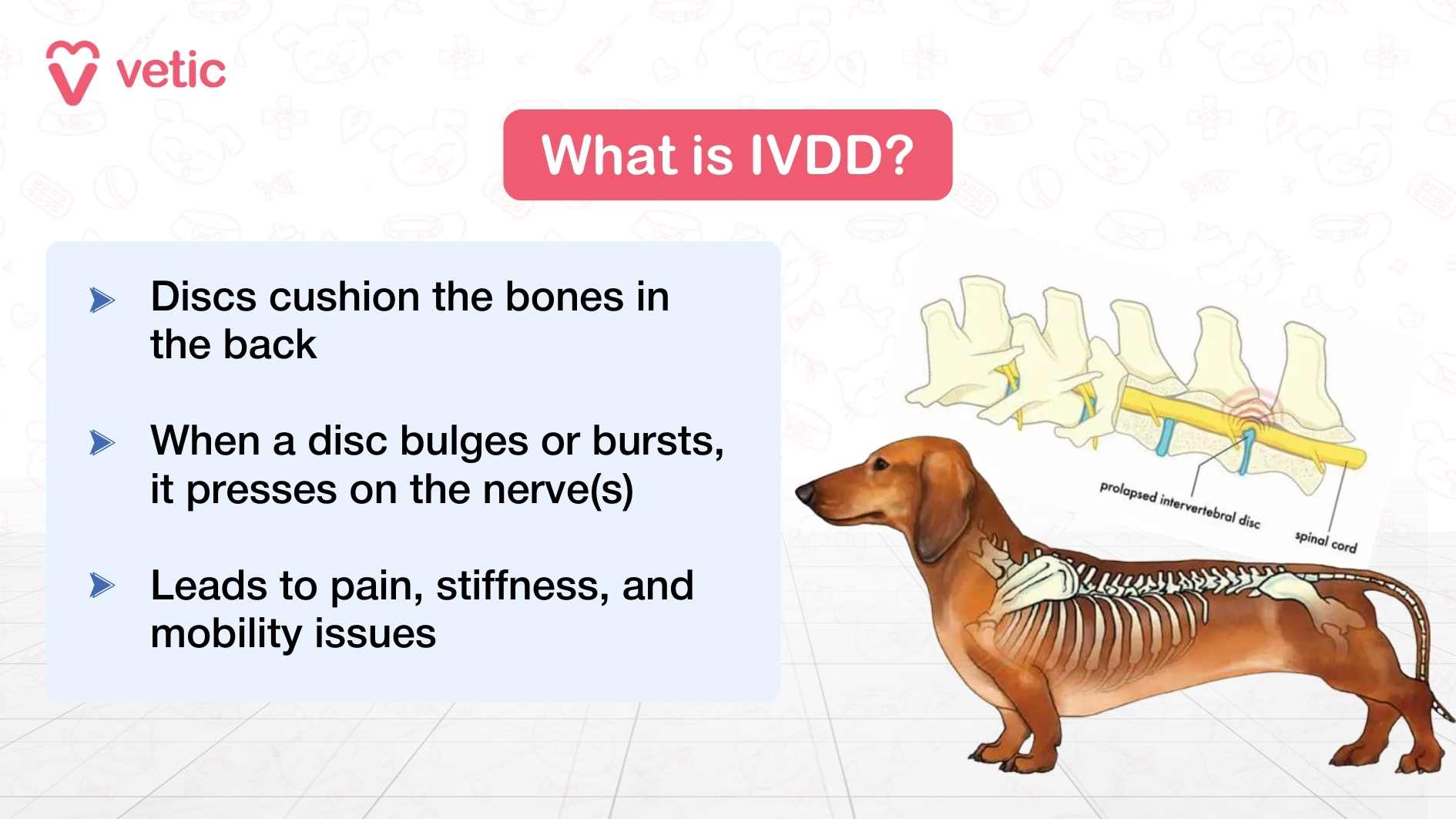 The infographic titled “What is IVDD?” explains the condition using simple language and visuals. It describes how spinal discs cushion the bones in the back, and when a disc bulges or bursts, it presses on nearby nerves. This results in pain, stiffness, and mobility issues for the dog. The image features a Dachshund with an anatomical illustration of the spine and discs, highlighting the site of disc prolapse.